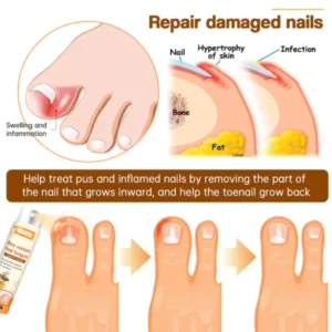 Bee Venom Nail Fungus Spray - Image 3