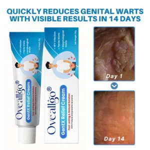 HPV Genital Warts Relief Cream - Image 2