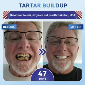 Tideglusib Fast‑Dissolving Tooth & Gum Repair Oral Strips - Image 4