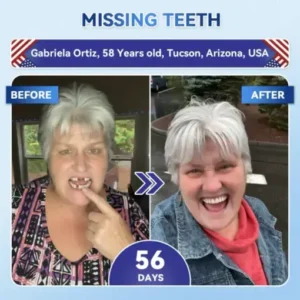 Tideglusib Fast‑Dissolving Tooth & Gum Repair Oral Strips - Image 3