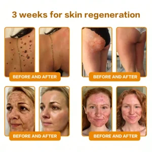 Bee Poison Skin Renewal Cream - Image 10