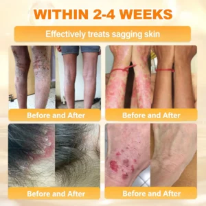 Bee Poison Skin Renewal Cream - Image 8