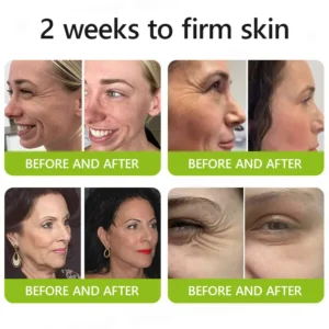 BOTOX & VITA A RETINOL SHOT Wrinkle Lift Tightening Cream - Image 3