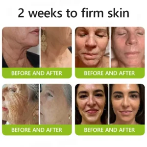 BOTOX & VITA A RETINOL SHOT Wrinkle Lift Tightening Cream - Image 4