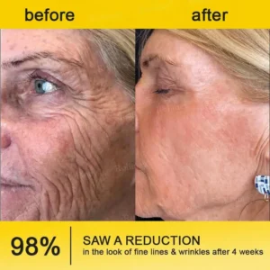 Botox & Vita A Retinol Shot Tightening Cream - Image 8