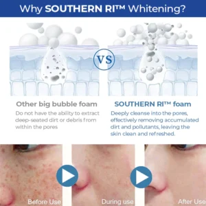 SOUTHERN Whitening Freckle Removal Cleanser - Image 5
