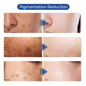 SOUTHERN Whitening Freckle Removal Cleanser - Image 8