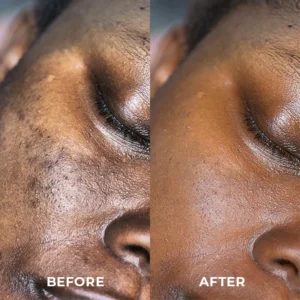 SOUTHERN Whitening Freckle Removal Cleanser - Image 7