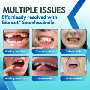 SeamlessSmile Silicone Reline Denture Set - Image 5