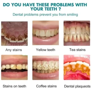 Skavix Instant White Smile Tooth Polish – Fast Stain Removal & Gentle Enamel Care - Image 6