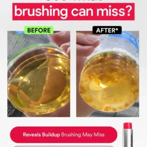 Stain Whitening Mouthwash - Image 3
