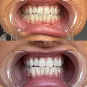 Stain Whitening Mouthwash - Image 6
