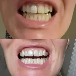 Stain Whitening Mouthwash - Image 7