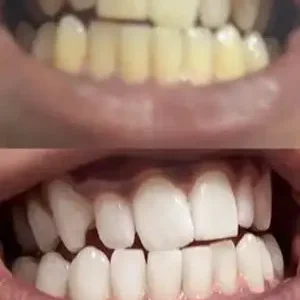 Stain Whitening Mouthwash - Image 8