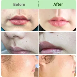 Hair Removal Cream for All Women & Men-Discounted Repeat Purchase - Image 4