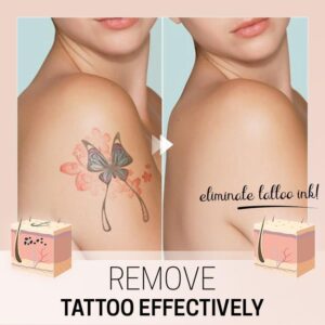 TatEraser Tattoo Removal Cream - Image 2