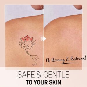 TatEraser Tattoo Removal Cream - Image 3