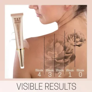 TatEraser Tattoo Removal Cream - Image 4