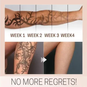 TatEraser Tattoo Removal Cream - Image 7