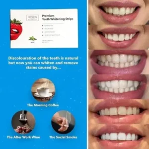 Teeth Whitening Strips - Image 2