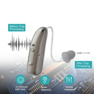 Smart hearing aids - Image 9