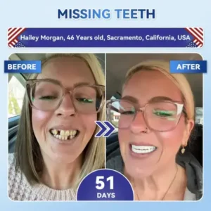 Tideglusib Fast‑Dissolving Tooth & Gum Repair Oral Strips - Image 4
