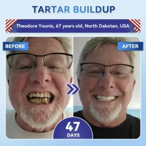Tideglusib Fast‑Dissolving Tooth & Gum Repair Oral Strips - Image 5
