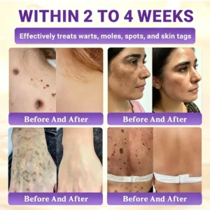 BioColla DermaRenew Cream - Image 5