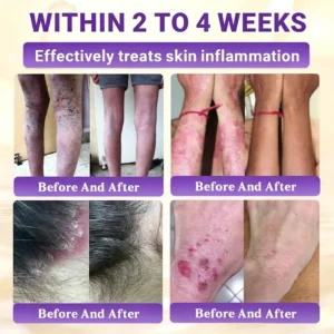 BioColla DermaRenew Cream - Image 6