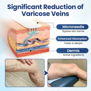 Deep Vein Repair Microneedle Patch - Image 5