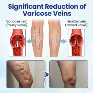 Deep Vein Repair Microneedle Patch - Image 6
