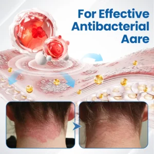 Fragile Skin Repair Cream - Image 12