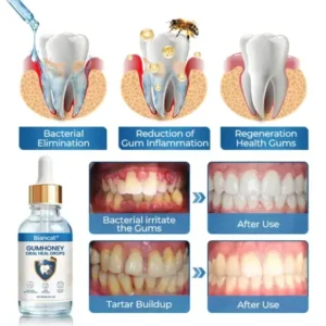 GumHoney Oral Repair Drops - Image 7