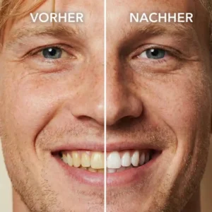 Tooth Polish - Instant Clean Smile! - Image 2