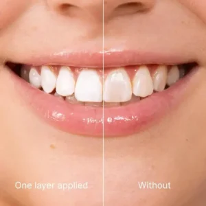 Tooth Polish - Instant Clean Smile! - Image 6