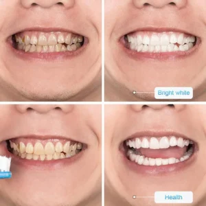 Viaty Stain Removal Whitening Toothpaste - Image 6