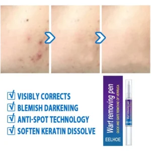 Wart removing pen - Image 4