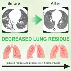 3X Concentrated Mullein Lung Cleanse Spray - Image 5