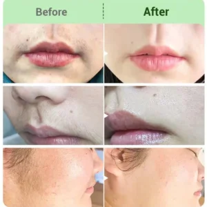 Painless Hair Removal Cream for Hormonal Facial Hair - Image 5