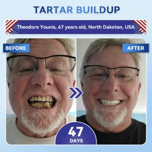 Tideglusib Fast‑Dissolving Tooth & Gum Repair Oral Strips - Image 4