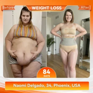𝐌𝐨𝐫𝐢𝐧𝐠𝐚 & 𝐁𝐞𝐫𝐛𝐞𝐫𝐢𝐧𝐞 𝟒-𝐈𝐧-𝟏 𝐌𝐢𝐜𝐫𝐨-𝐏𝐚𝐫𝐭𝐢𝐜𝐥𝐞 𝐒𝐜𝐮𝐥𝐩𝐭𝐢𝐧𝐠 & 𝐅𝐚𝐭-𝐁𝐮𝐫𝐧 𝐒𝐡𝐨𝐫𝐭𝐬 - Image 3