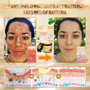 Alcuras Bee Venom Cream – Fast Skin Repair - Image 5