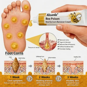 Bee Poison Wart & Corn Remover Cream - Image 5