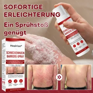 Schneckenmucin-Barriere-Spray zur Linderung von Hautschüben und zur Regeneration der Haut-𝘿𝙚𝙪𝙩𝙨𝙘𝙝𝙡𝙖𝙣𝙙𝙨 𝙉𝙧. 1 𝙨𝙥𝙧ü𝙝𝙗𝙖𝙧𝙚 𝘽𝙖𝙧𝙧𝙞𝙚𝙧𝙚-𝙋𝙛𝙡𝙚𝙜𝙚 𝙗𝙚𝙞 𝙋𝙨𝙤𝙧𝙞𝙖𝙨𝙞𝙨 - Image 2