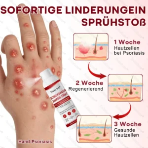 Schneckenmucin-Barriere-Spray zur Linderung von Hautschüben und zur Regeneration der Haut-𝘿𝙚𝙪𝙩𝙨𝙘𝙝𝙡𝙖𝙣𝙙𝙨 𝙉𝙧. 1 𝙨𝙥𝙧ü𝙝𝙗𝙖𝙧𝙚 𝘽𝙖𝙧𝙧𝙞𝙚𝙧𝙚-𝙋𝙛𝙡𝙚𝙜𝙚 𝙗𝙚𝙞 𝙋𝙨𝙤𝙧𝙞𝙖𝙨𝙞𝙨 - Image 5