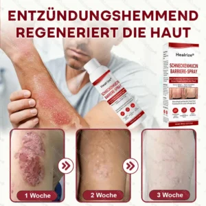 Schneckenmucin-Barriere-Spray zur Linderung von Hautschüben und zur Regeneration der Haut-𝘿𝙚𝙪𝙩𝙨𝙘𝙝𝙡𝙖𝙣𝙙𝙨 𝙉𝙧. 1 𝙨𝙥𝙧ü𝙝𝙗𝙖𝙧𝙚 𝘽𝙖𝙧𝙧𝙞𝙚𝙧𝙚-𝙋𝙛𝙡𝙚𝙜𝙚 𝙗𝙚𝙞 𝙋𝙨𝙤𝙧𝙞𝙖𝙨𝙞𝙨 - Image 6