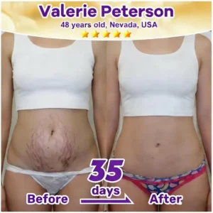 𝐀𝐜𝐞𝐭𝐲𝐥 𝐇𝐞𝐱𝐚𝐩𝐞𝐩𝐭𝐢𝐝𝐞-𝟖 & 𝐑𝐞𝐭𝐢𝐧𝐨𝐥 𝐀𝐝𝐯𝐚𝐧𝐜𝐞𝐝 𝐀𝐧𝐭𝐢-𝐖𝐫𝐢𝐧𝐤𝐥𝐞 𝐋𝐢𝐟𝐭 𝐂𝐫𝐞𝐚𝐦 - Image 18