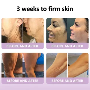 𝐀𝐜𝐞𝐭𝐲𝐥 𝐇𝐞𝐱𝐚𝐩𝐞𝐩𝐭𝐢𝐝𝐞-𝟖 & 𝐑𝐞𝐭𝐢𝐧𝐨𝐥 𝐀𝐝𝐯𝐚𝐧𝐜𝐞𝐝 𝐀𝐧𝐭𝐢-𝐖𝐫𝐢𝐧𝐤𝐥𝐞 𝐋𝐢𝐟𝐭 𝐂𝐫𝐞𝐚𝐦 - Image 6