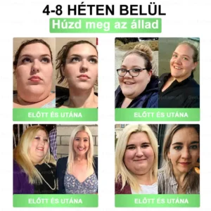 Glumasetide 8az 1-ben Karcsú és EgészségesNano Mikrotűs Tapasz - Image 4