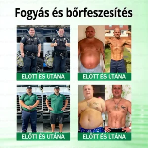 Glumasetide 8az 1-ben Karcsú és EgészségesNano Mikrotűs Tapasz - Image 5